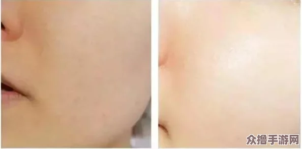 一面膜胸口一面膜下免费版，轻松焕肤让你肌肤水润透亮，告别干燥暗沉！